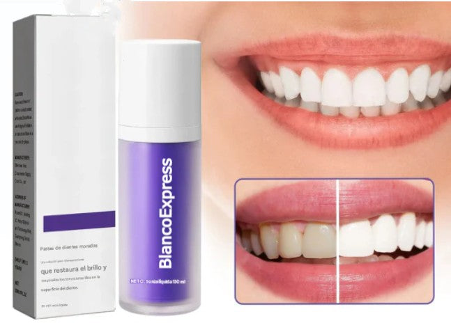 Blanqueador Dental Morada V34 ¨Dientes BlancoExpress¨ + Irrigador Dental Profesional de REGALO